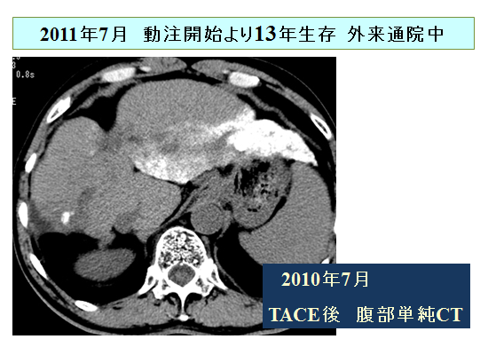 Low dose FP療法