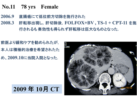 Case No.11 78歳女性